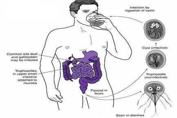 نقش دستگاه تصفیه آب در سلامتی بدن