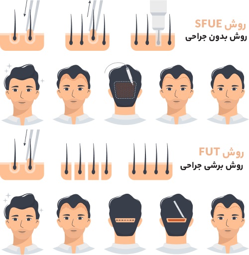 تفاوت روش SFUE با سایر روش ها