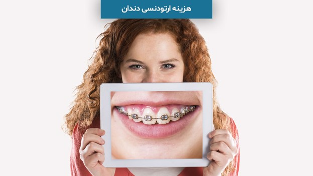 هزینه ارتودنسی در سال 1403 چقدر است؟ (شرایط ارتودنسی اقساطی) - implantdr